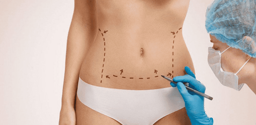 Abdominoplastia na Turquia - İberia Clinic